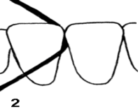 drawing two of flossing