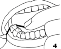 drawing four of flossing